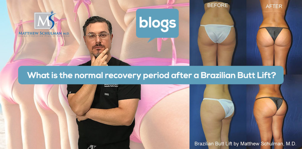 brazilian butt lift workout before after