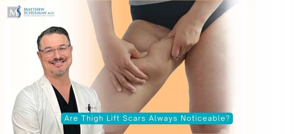 Are Thigh Lift Scars Always Noticeable