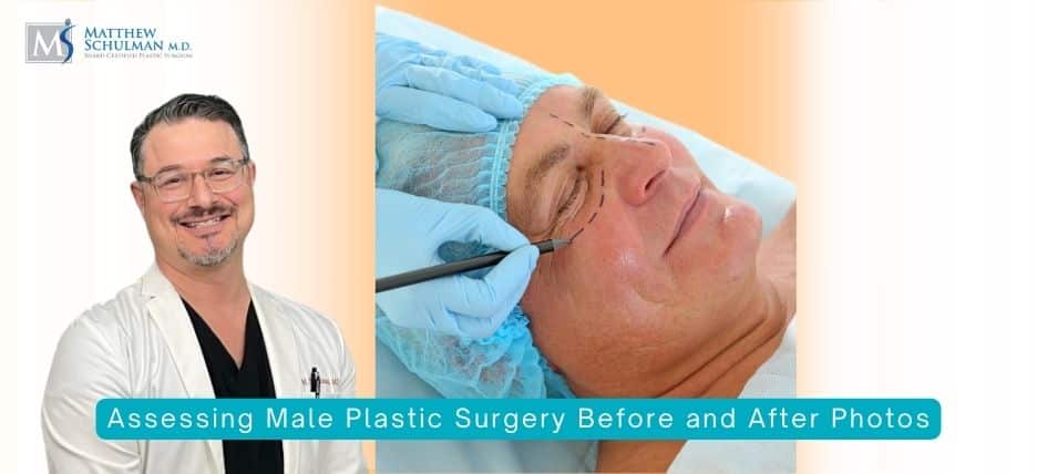 Assessing Male Plastic Surgery Before and After Photos