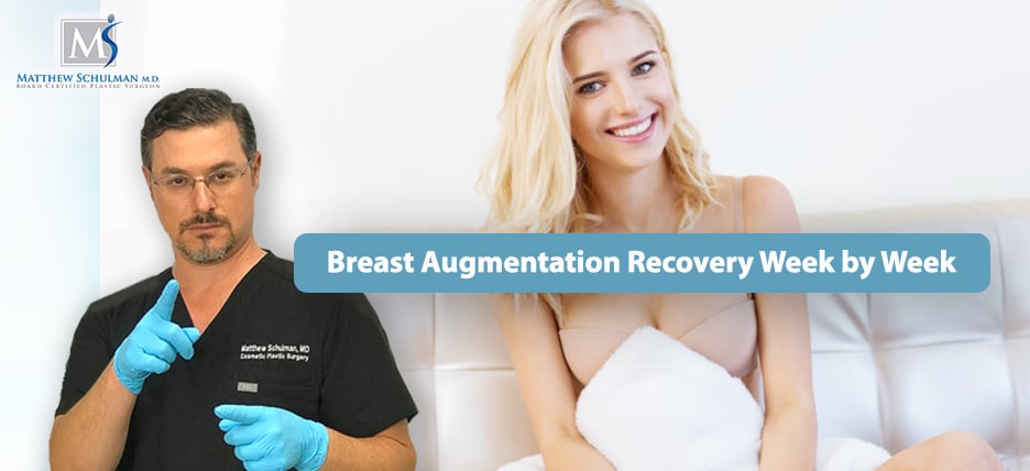 How to Prepare for Breast Augmentation Surgery: Matthew J. Matthew