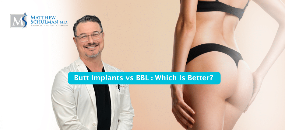 Brazilian Butt Lift Vs. Buttocks Implants