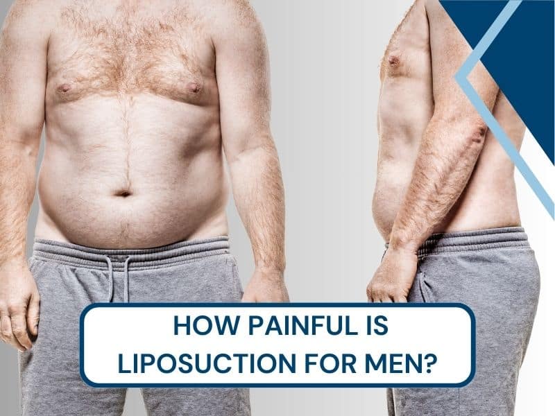 How painful is liposuction for men