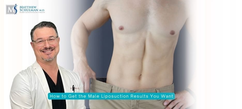 How to Get the Male Liposuction Results You Want