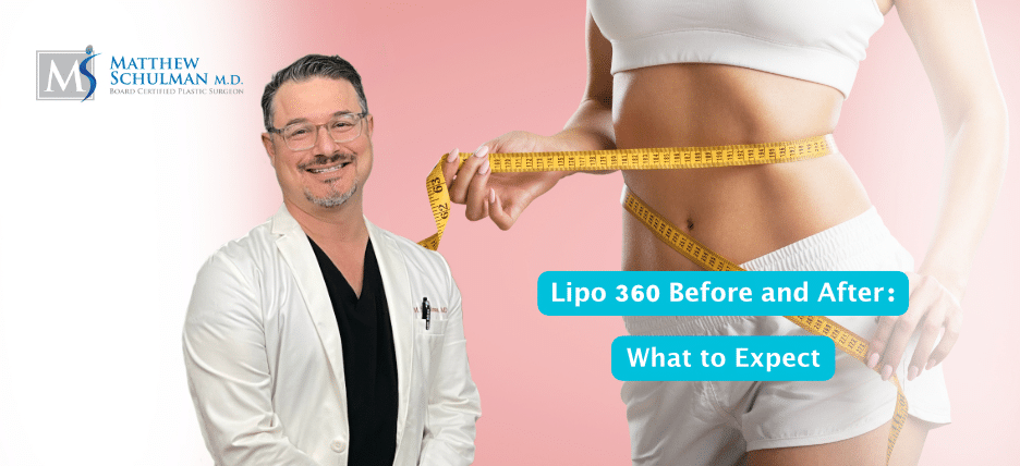 Slim Every Side of Your Body With Liposuction 360