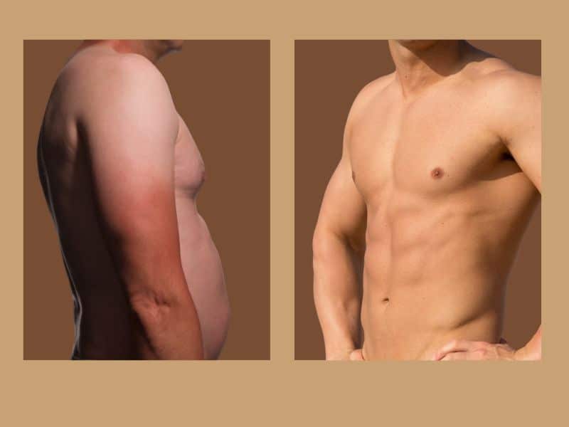 results for male liposuction